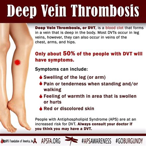 How Long Does Dvt Pain Last - Cares Healthy