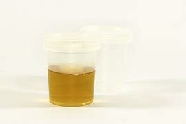 How Long Is Urine Good For A Drug Test? - The Freeman …