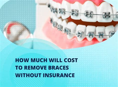 How Much Are Braces Without Insurance Reddit