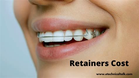 How Much Do Retainers Cost? Full Details - AdvisoryHQ