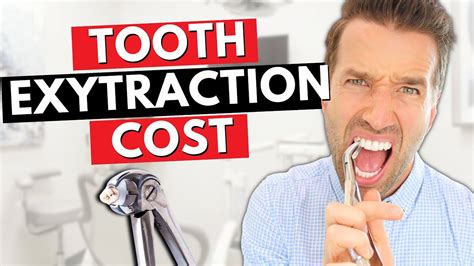 How Much Does a Tooth Extraction Cost Without …