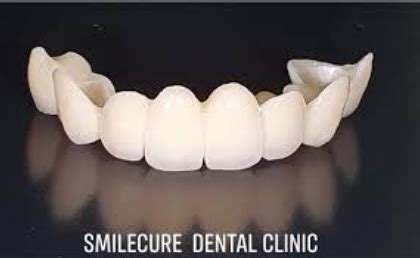 How Much Is Fix Bridge Teeth In Philippines TeethWalls