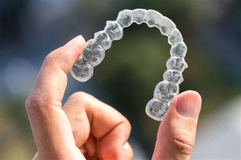 How Much Is Invisalign And Is It Worth It? Money