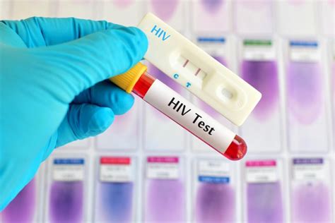 How Soon After Unprotected Can I Test For Hiv - HIVTalk.net