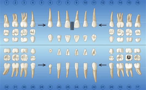How To Chart Missing Teeth On Dentrix Best Picture Of Chart