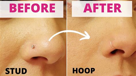 Why You Remove Piercings and Jewelry Before Surgery