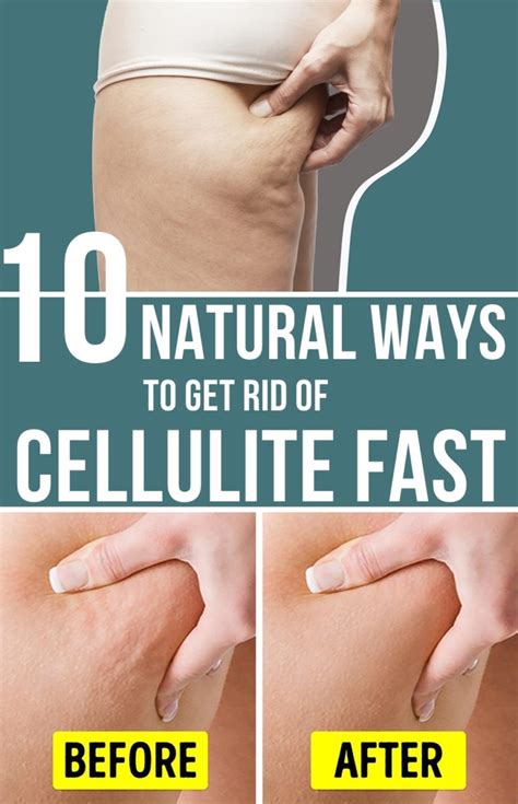 How To Get Rid Of Cellulite On Your Stomach