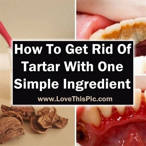 How To Get Rid of Tartar with ONE Simple Ingredient HEALTH AND DIY IDEAS