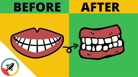 How To Make Your Teeth Crooked 2 UNSUSPECTED WAYS!