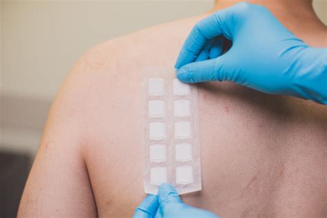 How To Pass A Skin Patch Drug Test