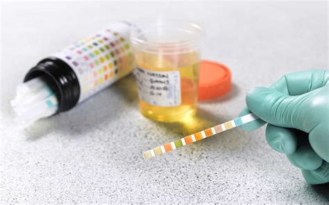 How To Pass A Urine Drug Test Temperature