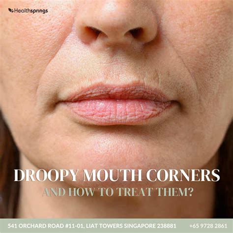 How To Prevent Drooping Lips