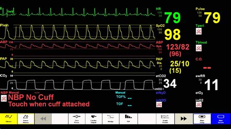 How To Read A Patient Monitor Numbers And Lines Explained