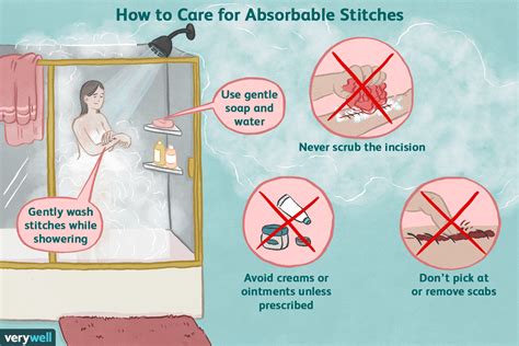How To Take Care Of Stitches