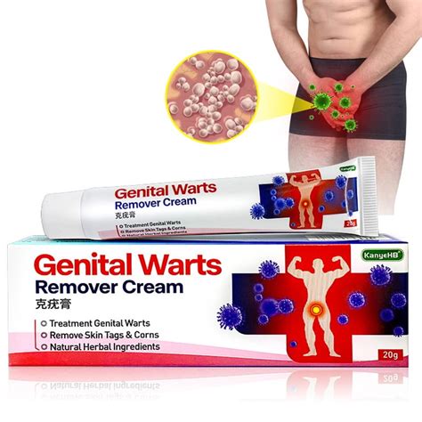 How To Treat And Cure HPV Anal Warts- Anal Wart Ointment