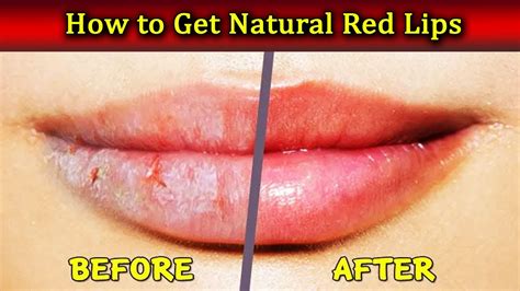 How To Treat Sore Red Lips Naturally Lipstutorial.org