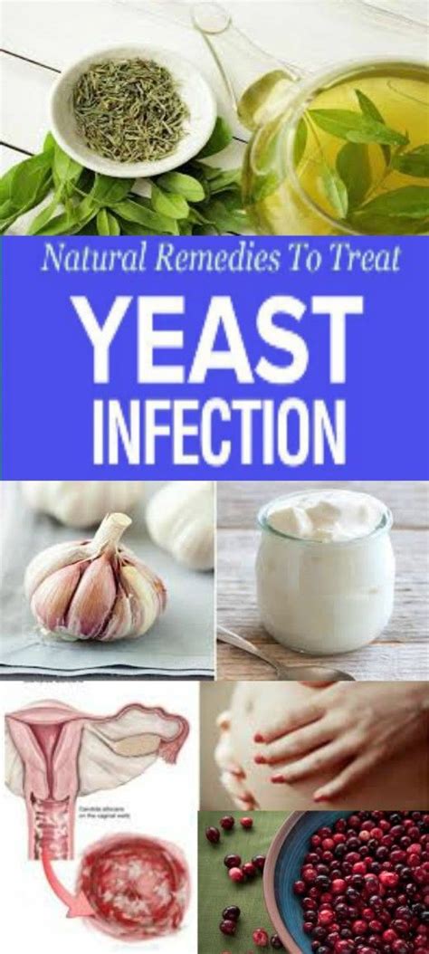 How To Treat Yeast Infections Naturally - YeastAdvice.com