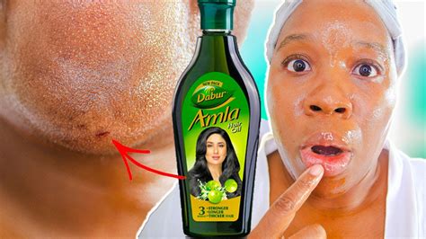 How To Use Amla Oil & Amla Powder For Hair Growth