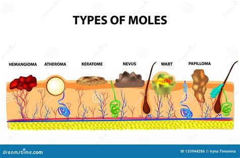 How a mole is formed