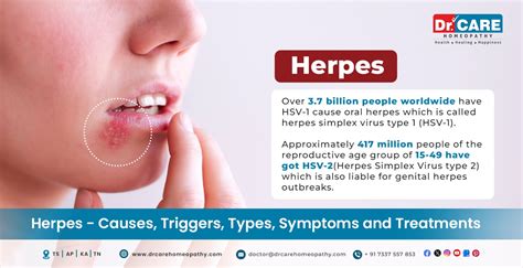 How bad is living with herpes