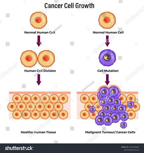 How big is a cancer cell