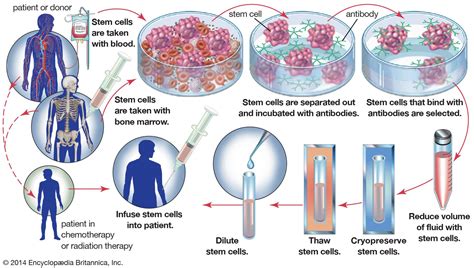 How bone marrow is transplanted