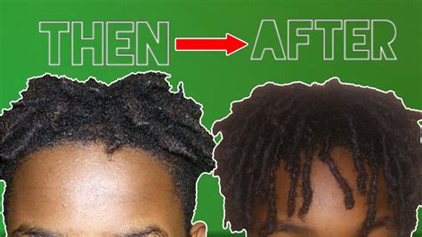 Before you worry about styling dreads, you need to grow them. Thu