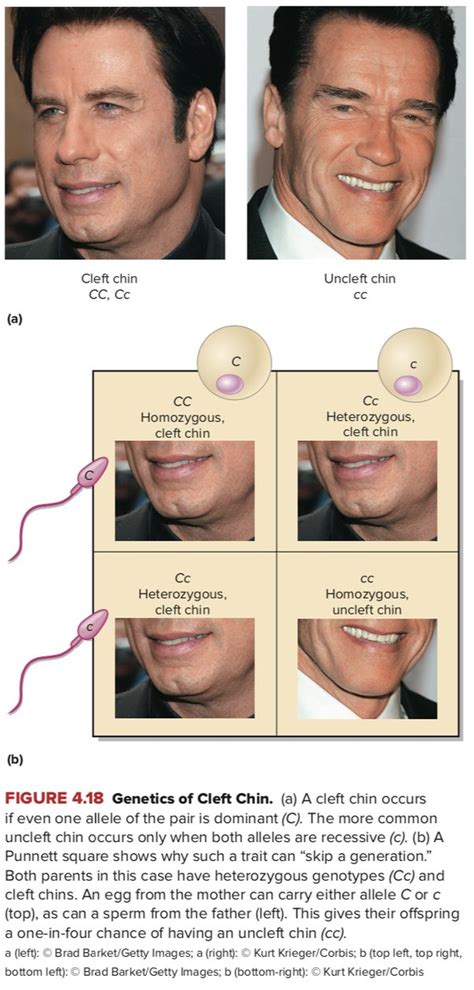 How common are cleft chins? - Quora