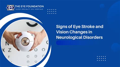 How common is an eye stroke