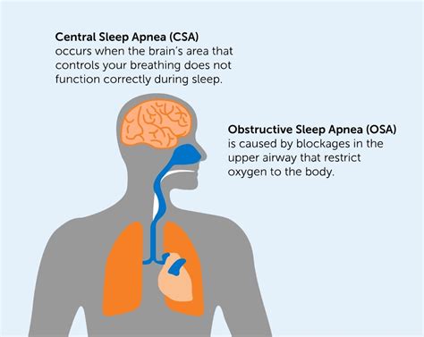 How common is central sleep apnea