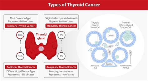 How common is thyroid cancer