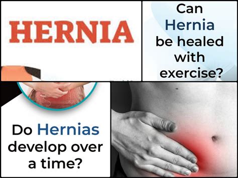 How dangerous is a hernia