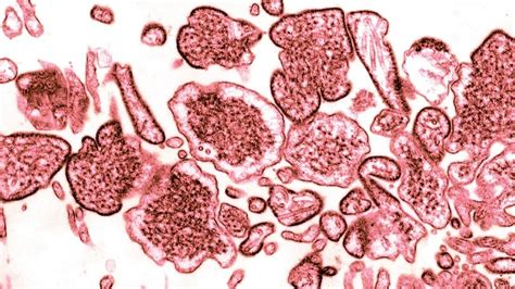 How deadly is Langya virus Symptoms and causes explored as China records 35 cases