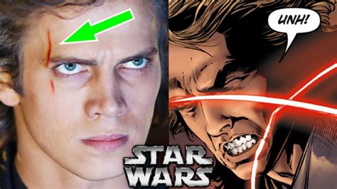 Follow Star Wars Reading Club on Twitter: @SWReadingClubThe Non-Canon Expert is back to describe how Anakin Skywalker received the vertical scar beside his r.... 