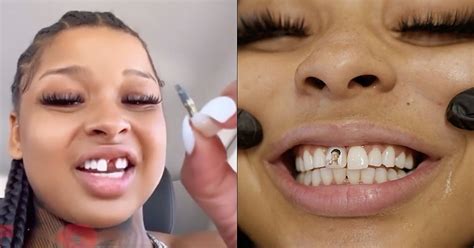 According to Distractify, Chrisean Rock lost her tooth during a fight she had with Blueface's ex-girlfriend and baby mama, Jaidyn Alexis. The incident happened when Chrisean was living with Blueface and several other women in his house as part of his reality show, Blue Girls Club.