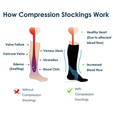 How do Compression Socks Improve Circulation? - Fitspires