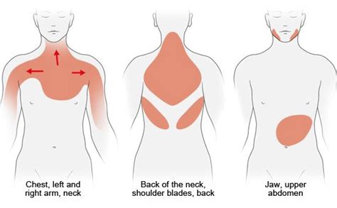 How do I know if my shoulder pain is a heart attack?