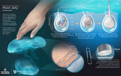 How do jellyfish sting. The sting is usually no more harmful than an insect bite, but reaction to the toxin can vary greatly. Stings from the box jellyfish or Portuguese man-of-war can result in severe pain and, in some ... 