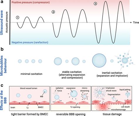 How do microbubbles and ultrasound interact? Basic physical