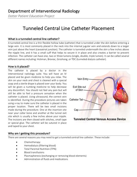 How do you know if a central line is tunneled? - TimesMojo