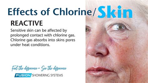 How does chlorine affect skin? HowStuffWorks