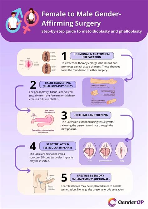 How does ftm bottom surgery work.  Examples of 'does' in a sentence does Thes...