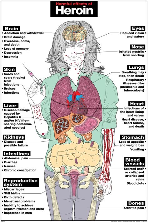 How does heroin affect the heart 