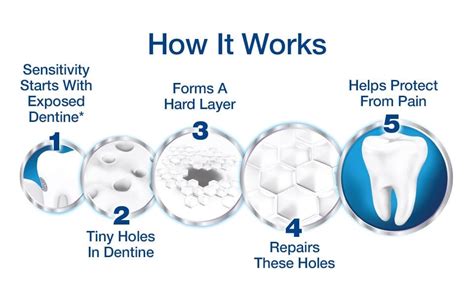 How does sensodyne work. Forklifts are a necessary tool in most warehouses, shipping depots and manufacturing facilities. Learn how forklifts work. Advertisement Most of us probably have a general idea of ... 