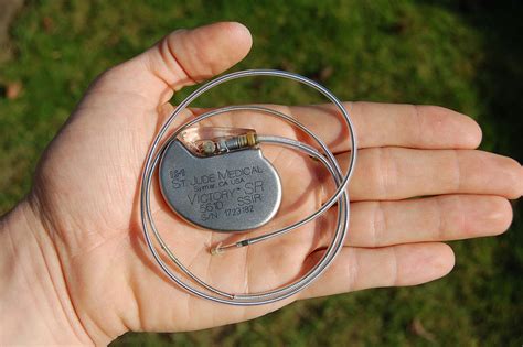 How does the battery in a pacemaker get replaced? - Quora