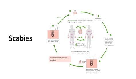 How easily is scabies spread