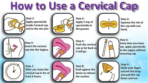 How effective is cervical cap