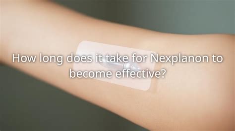 How effective is nexplanon