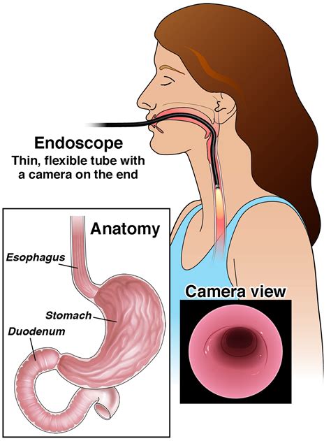 How endoscopy test is done