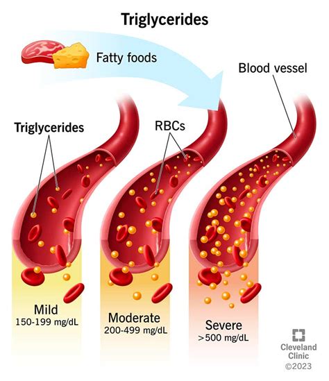 How high should your triglycerides be